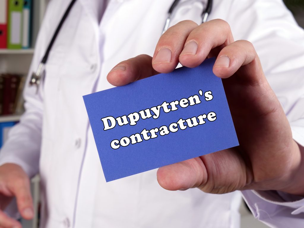 Dupuytren's Contracture, Veda Medical