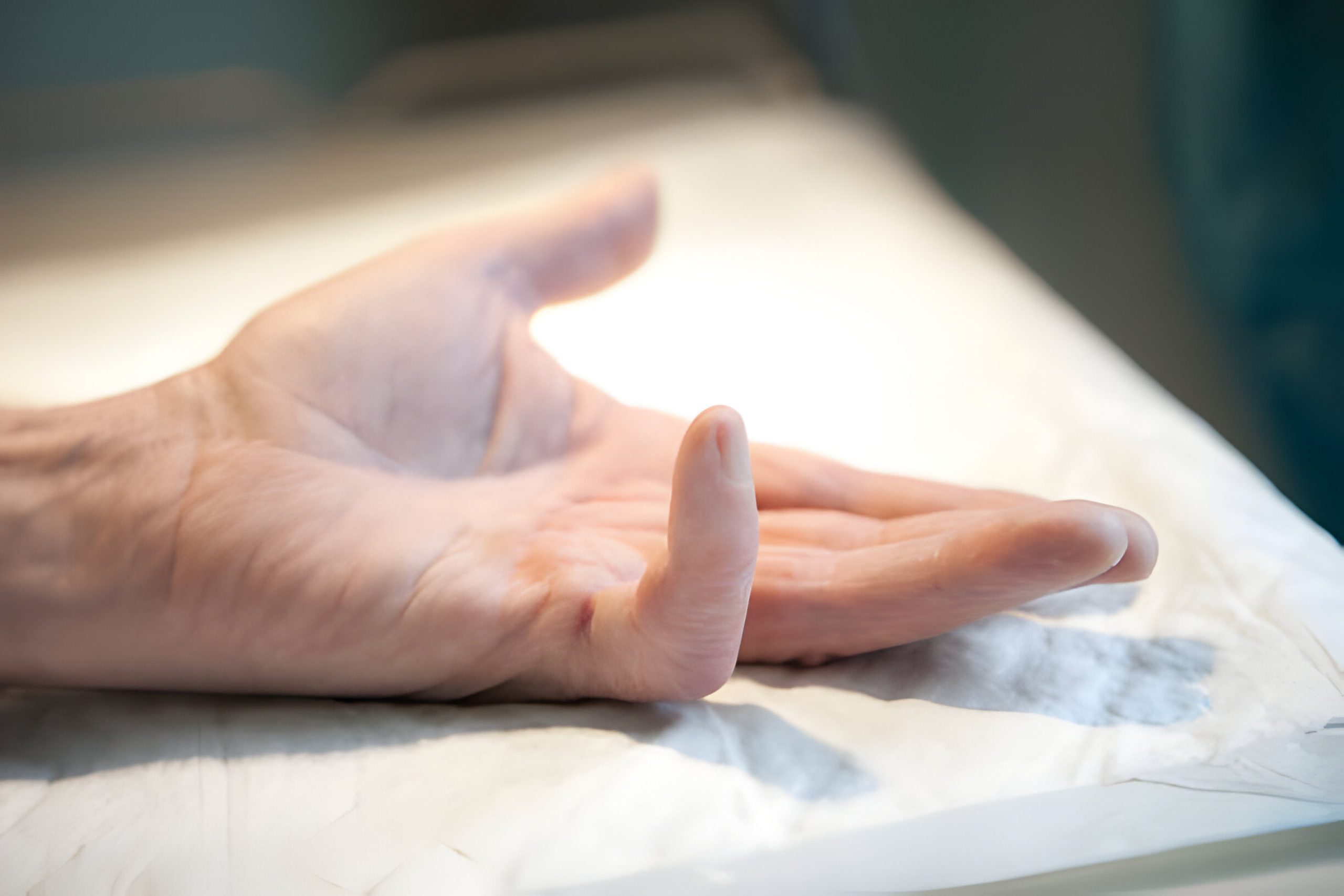 Early Signs of Dupuytren's Contracture and Treatment Options